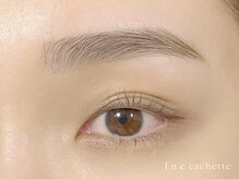 エンカシェット 代官山(En’e cachette)/【矯正美眉】憧れの黄金比率！