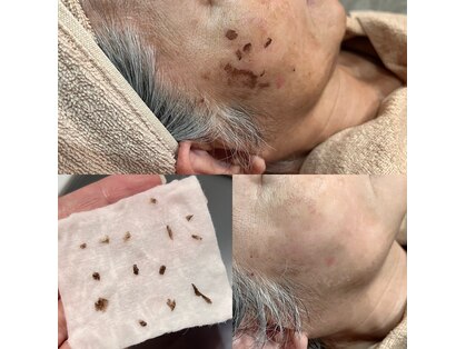 コスメ デ グレース(cosme de greace)の写真