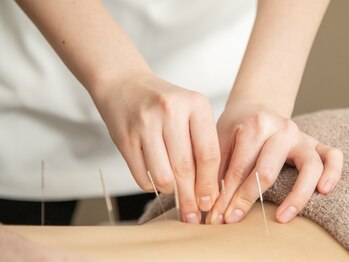 鍼灸サロン アヤカ(AYAKA)/鍼灸施術で全身メンテナンス！