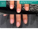 自信が持てる綺麗な美爪へ
