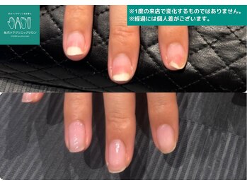 地爪ケアクリニックサロン 代々木店/自信が持てる綺麗な美爪へ