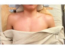 アイスパ 代官山(i-SPA)/肩こり、背中のはりが一気に楽に