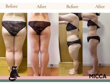 ヨサパーク ミッカ 学芸大学(YOSA PARK MiCCA.)/全身痩せ驚愕の結果　パート１