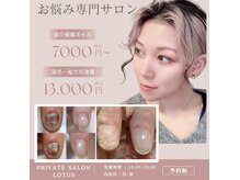 ロータス(LOTUS)の雰囲気（特殊ネイリストが施術するお悩み超特化型ネイルサロン♪）