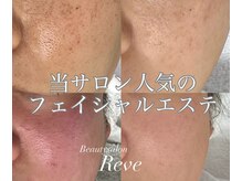 レーヴの雰囲気（ハイドラピーリングで毛穴洗浄！黒ずみをしっかり除去☆）