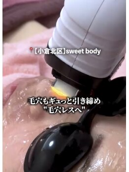 スウィートボディ(Sweetbody)の写真/透明感あふれる毛穴レス美顔に♪小鼻、眉間まで顔全体をくまなく脱毛し化粧ノリＵＰ！
