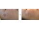 エンヴィー ESTHETIC&SPA ENVYの写真/薄いシミから濃いシミまで根本から改善☆お肌に負担をかけずに、一度の照射でシワも改善しハリもUP！