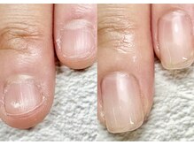 ネイルサロン ミノアッカ(mino'aka)の雰囲気（ジェルに頼らない！栄養＆血流×自爪育成ネイルケアで縦爪に）