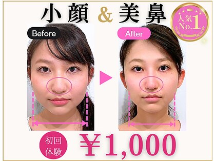 ラプリ 大阪心斎橋店(Raplit)の写真