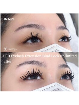 スウィートアイズ(Sweet eyes)/LEDバインドロック つけ放題