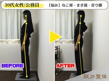 幸せのもり整体院/【30代女性／公務員】Oさん