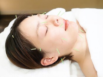 アキュレ(Acure)の写真/【和漢の上質空間】輪郭のもたつきや二十顎…リフトアップフェイシャル美容鍼+ドライヘッドスパ3300円～☆