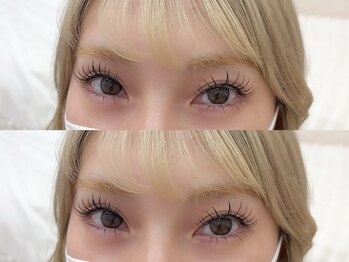 ソア(soa.)/LED上下(Haruka施術)