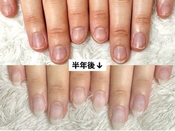 グレースレディ 大阪店/(深爪/長さだし/フィルイン)