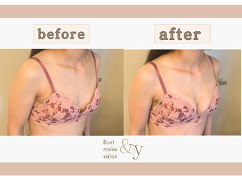 アンド ワイ(&y)/20代女性/出産歴なし