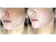 クレビア(CREBIA)/