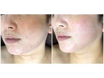 クレビア(CREBIA)/