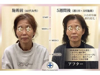 井原鍼灸整骨院/IAB美容鍼