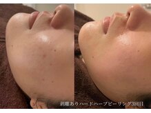 アールイーサロン(Re:salon)の雰囲気(【季節の変わり目のゆらぎ】ホームケア方法もしっかりアドバイス)