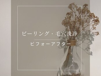 ラビ(RABBI)/毛穴洗浄/ピーリング効果写真