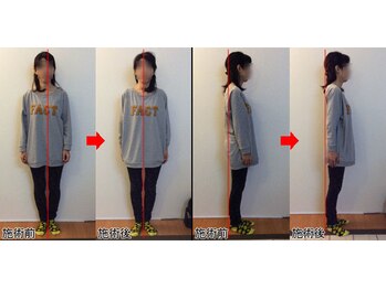 整体院プラス/全身スタイル矯正モニター