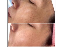 美キュート/8.お仕上げ