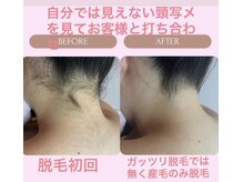ファーレイン 長崎市の雰囲気（うなじ脱毛大人気♪生え際の形をしっかり打ち合わせ！！）