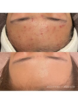 エクラ(eclat)/クリスティーナ