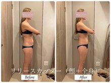 リノ(Lino)/顔＋全身リリースカッター