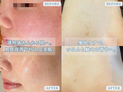 エヌエースキン たまプラーザ店(NAskin)の写真