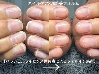 ホロムアガーデン 芝(Holomua Garden)の写真/二枚爪ストレスから解放されたい,甘皮の角化による見映え悪化を改善したい,爪の形を改善したい方に★男性可