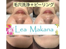 レアマカナ(LeaMakana)/毛穴洗浄＋ピーリング