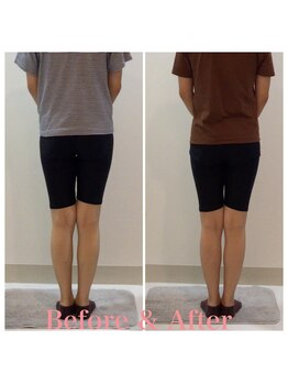 スタイルラボ高松/産後骨盤矯正の効果♪