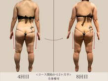 エル 麻布十番(LllL)/【痩身】2ヶ月半ビフォアフ