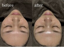 ビビ(Vivi)/水光肌へ！！！