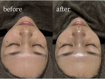 ビビ(Vivi)/水光肌へ！！！