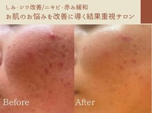 ルアーナ(Luana)