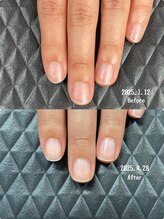 クーラ アンド ベリッシモ(Cura&Bellissimo)/