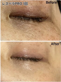 ベルミーランド イオン長浦/