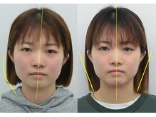 宮崎整体院/【美容整体】全身根本改善コース