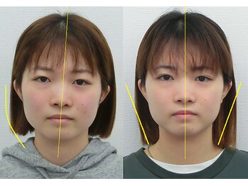 宮崎整体院/【美容整体】全身根本改善コース