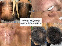 オウジエステサロン(OJIエステサロン)