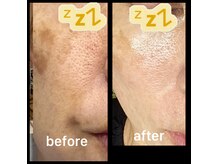 ココスタイルビューティー(COCOSTYLE beauty)の雰囲気（シミケアはここまで変わる積み重ねた技術で導く技術）