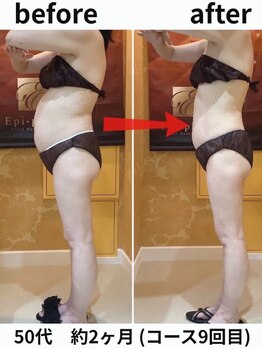 エピファニー(Epi phany Total Beauty Salon)/【ダイエット/サイズダウン】