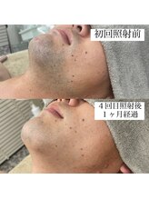 テンパ ビューティー(+10%beauty)/効果写真