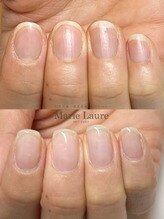 マリーロール 梅田店(Marie Laure)/自爪育成/深爪矯正/ネイルケア