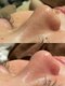 ホワイトラボ 堺東(White labo)の写真/【韓国肌管理】韓国人のような毛穴レスな透明感爆発の肌に…◎