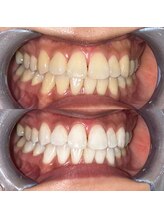 ライトビューティー 池袋店(LightBeauty)/症例写真