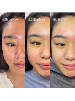 セレーノ 横浜店(seReno)/トータルケア☆