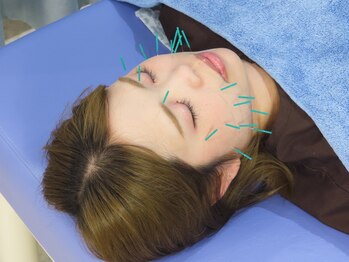 赤沼鍼灸整骨院/リフトアップで小顔に！！！